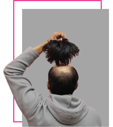 How Long Do Hair Wigs Last?